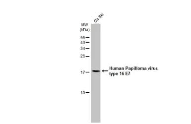 Human Papilloma Virus Type 16 E7 Antibody Hl1647 Ab308180  Western Blot Img407181