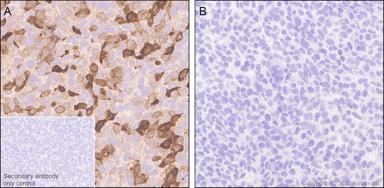 Anti-Bassoon/BSN antibody [L124-59](AB306593)