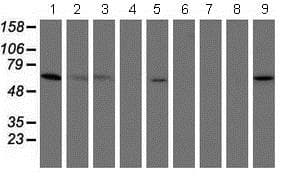 Anti-PGM3 antibody [OTI1A11](AB128094)
