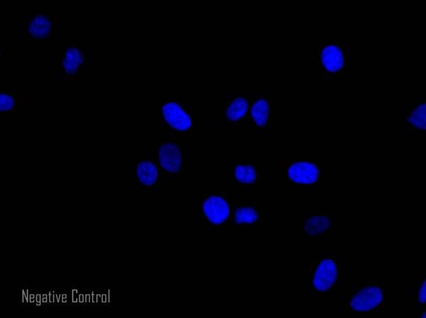 Donkey Anti-Rabbit IgG H&L (Alexa Fluor® 568) preadsorbed(AB175693)