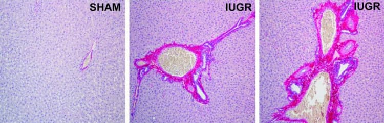 Picro Sirius Red Stain Kit (Connective Tissue Stain)(AB150681)