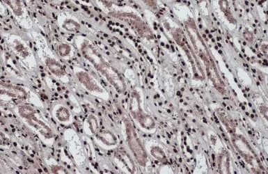 Anti-Histone H2A.Z antibody - ChIP Grade(ab97966)