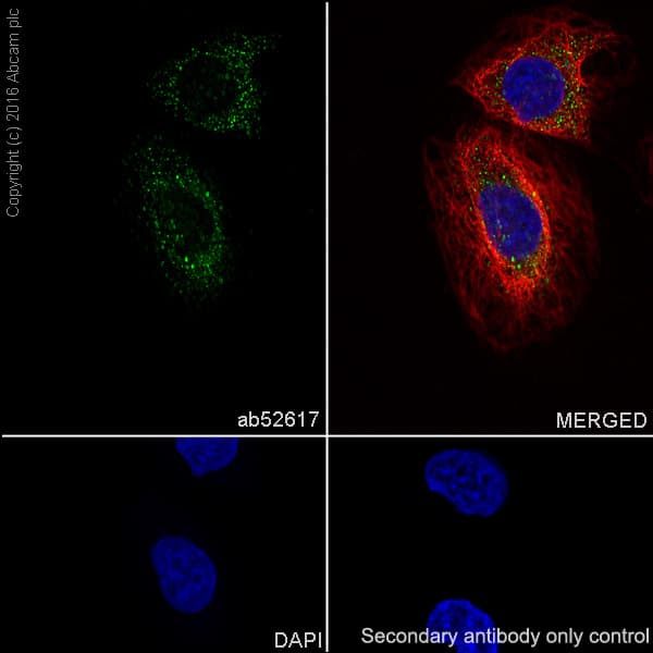 Anti-ABCG1 antibody [EP1366Y] - BSA and Azide free(AB218528)