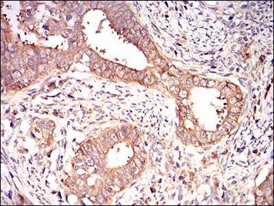Eif2a Antibody 3a7b11 Ab181467  Immunohistochemistry Formalin Pfa Fixed Paraffin Embedded Sections Img76674