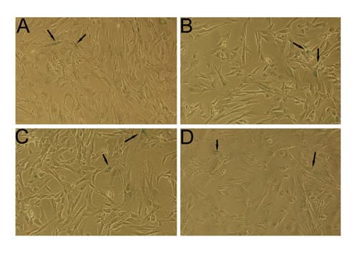 Senescence Detection Kit(AB65351)