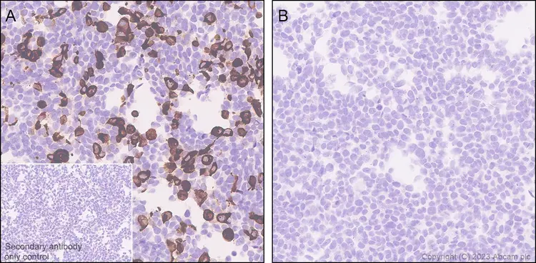 Anti-Streptococcus mutans Cell surface antigen I/II antibody [EPR28235-11](AB316006)