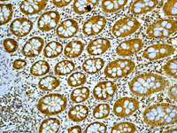 Fkbp52 Antibody Epr6618 Bsa And Azide Free Ab240535  Immunohistochemistry Formalin Pfa Fixed Paraffin Embedded Sections Img136641