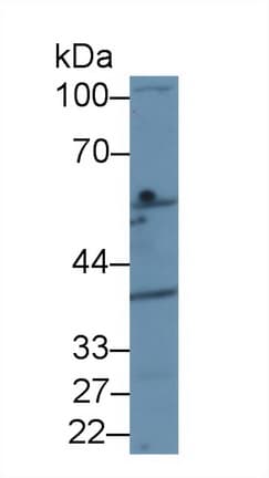 Anti-D2HGDH antibody(AB233516)