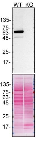 Anti-PPP2R5D antibody [EPR15617-50] - BSA and Azide free(AB250953)
