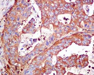 Cap1 Antibody Epr8339b Ab155079  Immunohistochemistry Formalin Pfa Fixed Paraffin Embedded Sections Img79259