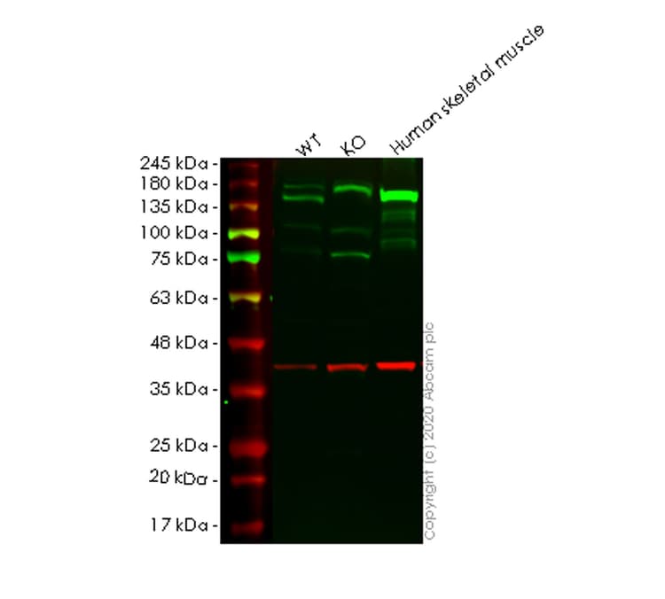 Anti-Collagen VI antibody [EPR17072](AB182744)
