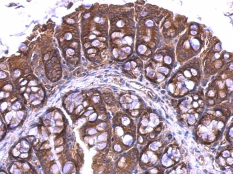 Rpl4 Antibody Ab154907  Immunohistochemistry Formalin Pfa Fixed Paraffin Embedded Sections Img100582