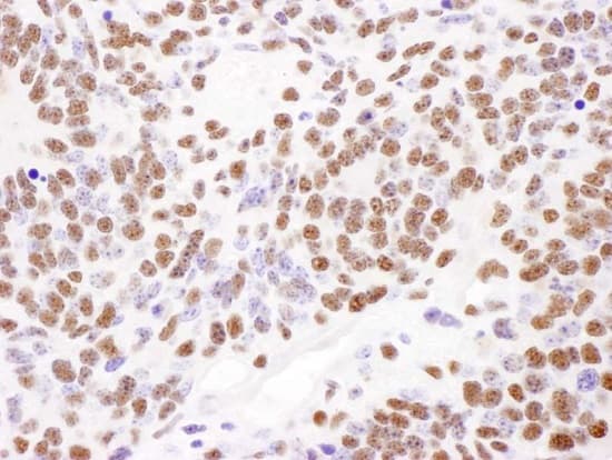 Pabpn1 Antibody Ab241477  Immunohistochemistry Formalin Pfa Fixed Paraffin Embedded Sections Img112768