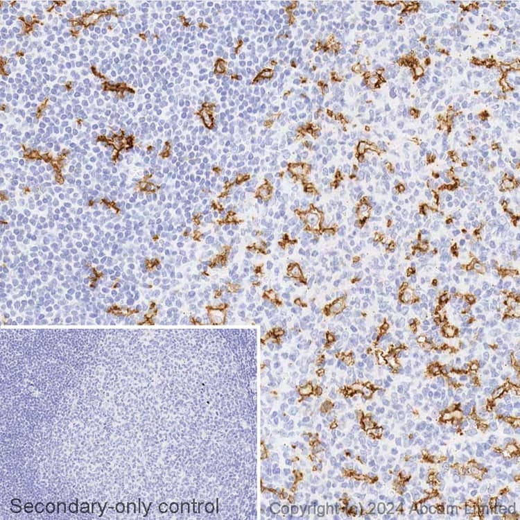 Avidin/Biotin Blocking Kit(ab64212)