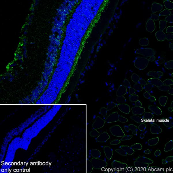 Anti-Dystrophin antibody [EPR23336-129](AB275391)