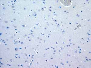Anti-Myosin light chain 3 antibody [EPR4160] - BSA and Azide free(AB247710)