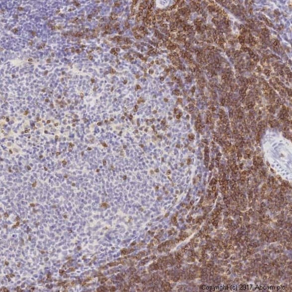 Anti-CD3 epsilon antibody [SP7] - BSA and Azide free(AB205228)