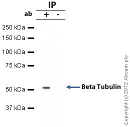 Anti-beta Tubulin antibody - Loading Control(AB6046)