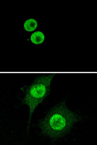 Anti-HMGB1 antibody [EPR3507](AB79823)