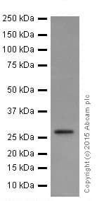 Kcnip4 Antibody Epr18314 Bsa And Azide Free Ab251403  Western Blot Img151270