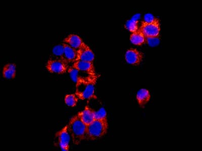 Anti-Alas1 antibody [EPR10247] - Mitochondrial Marker(AB154860)