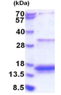 Ab183250  Sds Page Img21807