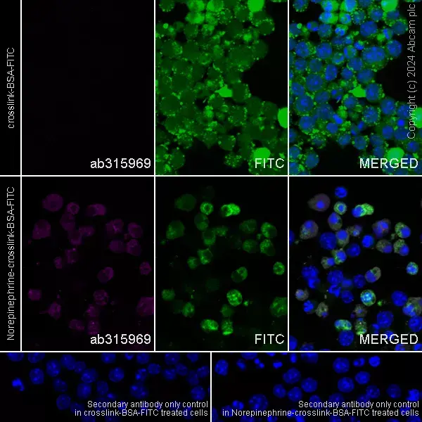 Anti-Noradrenaline antibody [EPR24435-114](AB315969)