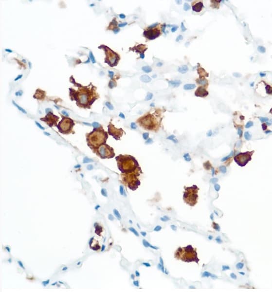 Cd16 Antibody Sp175 Ab183354  Immunohistochemistry Formalin Pfa Fixed Paraffin Embedded Sections Img57785