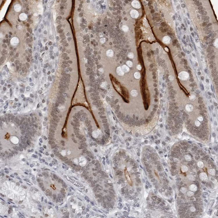 Espin Antibody Ab254774  Immunohistochemistry Formalin Pfa Fixed Paraffin Embedded Sections Img102060