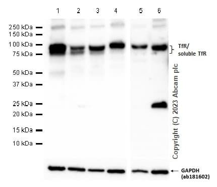 Anti-Transferrin Receptor antibody [EPR20584](AB214039)