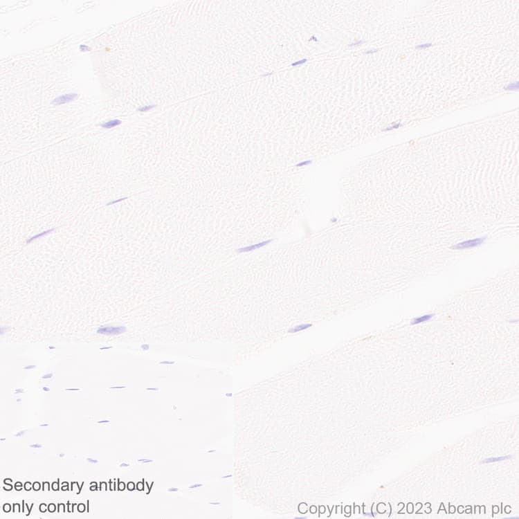 B4galnt1 Antibody Epr28064 64 Ab314130  Immunohistochemistry Formalin Pfa Fixed Paraffin Embedded Sections Img420039