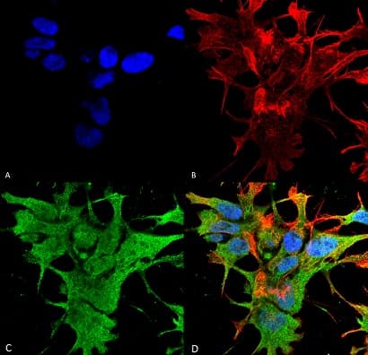 Anti-Dicer antibody [N167/7](AB167444)