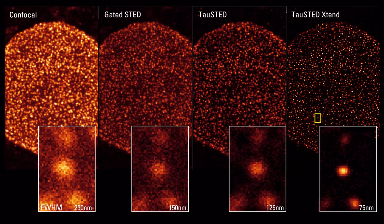 From Confocal To TauXTED Xtend Crop Kid21764610