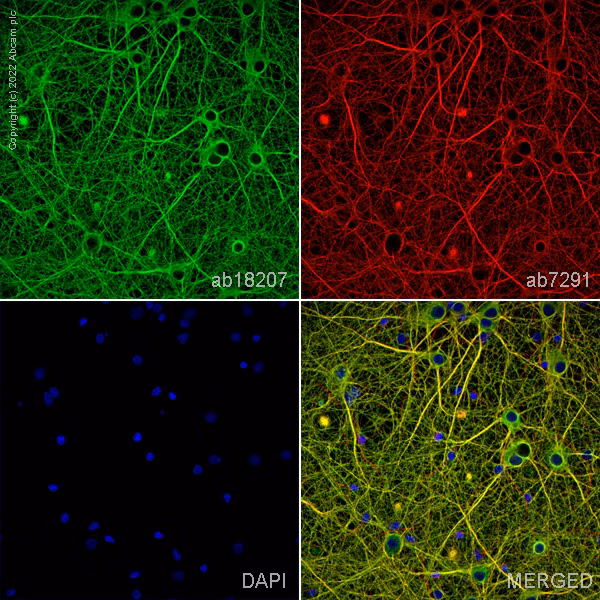 Beta Iii Tubulin Antibody Neuronal Marker Ab18207 Immunocytochemistry Immunofluorescence Img167786