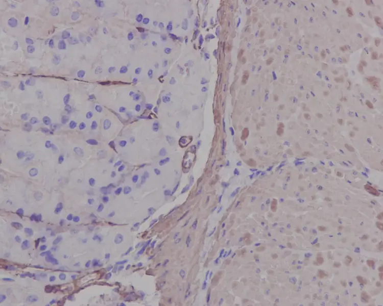 Anti-alpha smooth muscle Actin antibody [EPR5368](AB124964)
