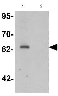 Kpna5 Antibody Ab125529  Western Blot Img126623