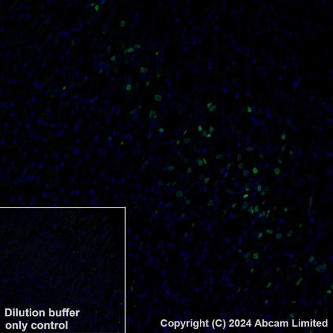 Anti-Ki67 antibody [B56](AB279653)