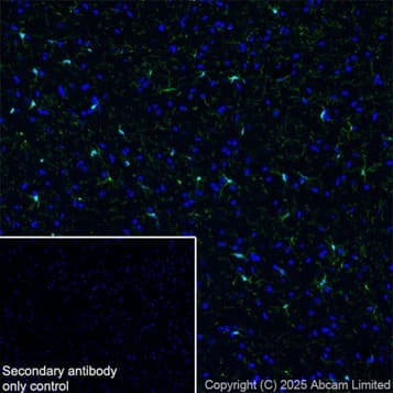Anti-Iba1 antibody [EPR16588] – Chicken IgY (Chimeric)(AB318302)