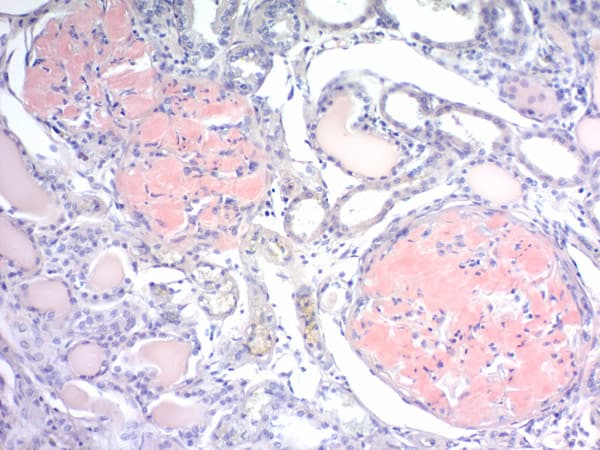 Congo Red Stain Kit (Amyloid Stain)(AB150663)