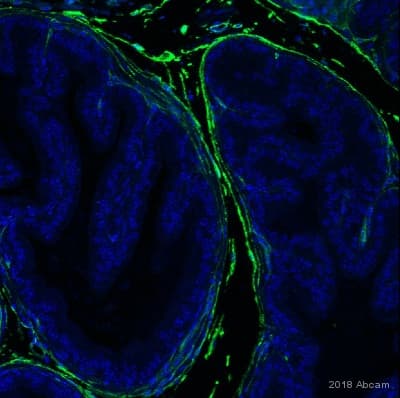 Anti-CD34 antibody [EP373Y](AB81289)