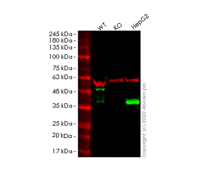 Anti-Apolipoprotein E antibody [EP1374Y](AB52607)