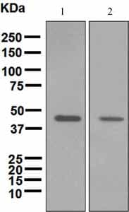Anti-Perilipin 2 antibody [EPR3713](AB108323)