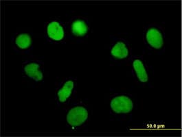 Rpa14 Rpa3 Antibody Ab167593  Immunocytochemistry Immunofluorescence Img6254
