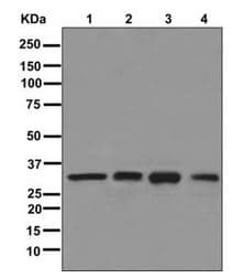 Capzb Antibody Epr10236 Ab175212  Western Blot Img62672