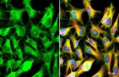 Fxr1 Antibody Ab155124  Immunocytochemistry Immunofluorescence Img451025