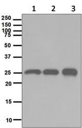 Hmgb2 Antibody Epr6301 Ab124670  Western Blot Img108170