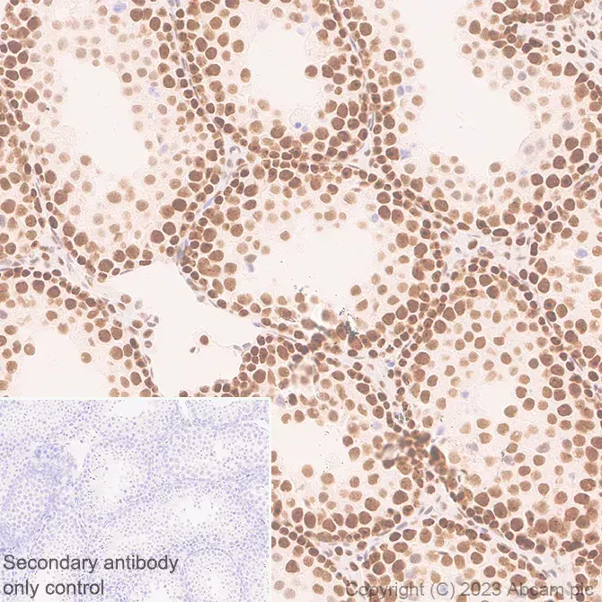 Anti-METTL16 antibody [EPR27236-78](AB313743)