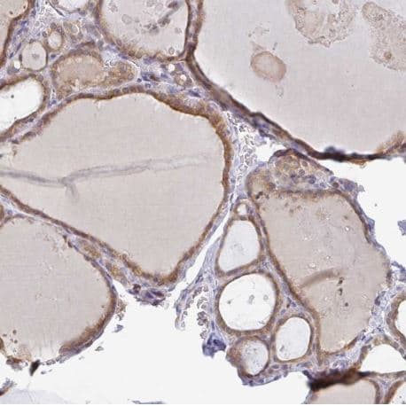 Derlin 2 Antibody Ab185087  Immunohistochemistry Formalin Pfa Fixed Paraffin Embedded Sections Img134584