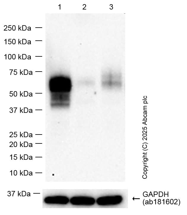 Anti-uPA Receptor/U-PAR antibody [EPR26916-73](AB307895)