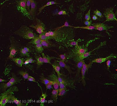 Anti-Fibronectin antibody [F14](AB45688)